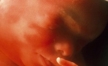 Rynek domowej aborcji. Planned Parenthood w walce. PODPISZ PETYCJĘ !! PolitykaPolska Dziecko 22 tydzien