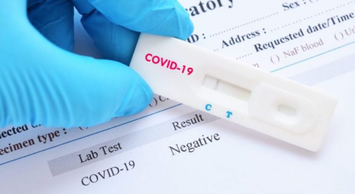 Covid-19-PCR-Test
